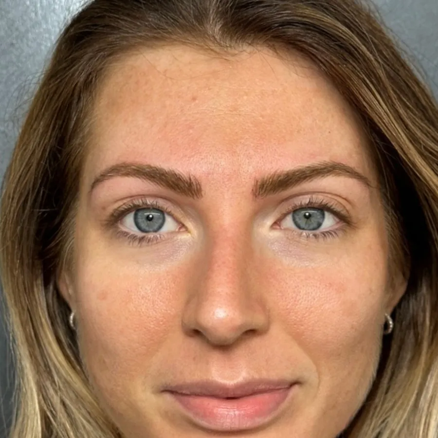 Trucco permanente sopracciglia effetto pelo: confronto prima e dopo a guarigione completata
